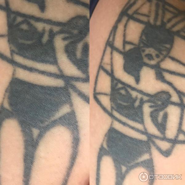 Татуировка до и после снятия пленки
