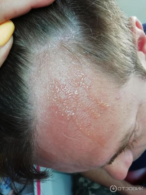 Средство для роста волос Minox Lotion-spray for hair growth 10 Men's для мужчин фото