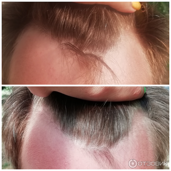 Средство для роста волос Minox Lotion-spray for hair growth 10 Men's для мужчин фото