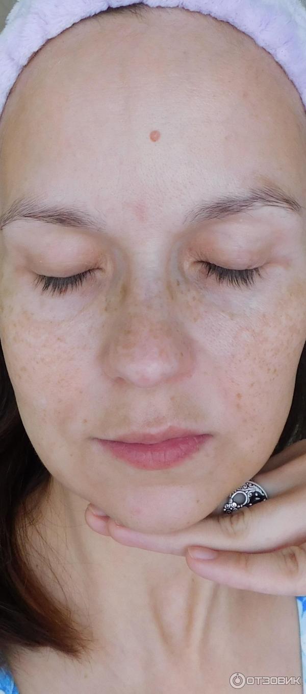 тональный скатывается на лице. сыворотка скатывается на лице. сс крем нл beige. кожа до после пилинг скатки. сыворотка скатывается на лице.